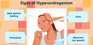 Hormonal imbalance