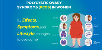 PCOS Treatment